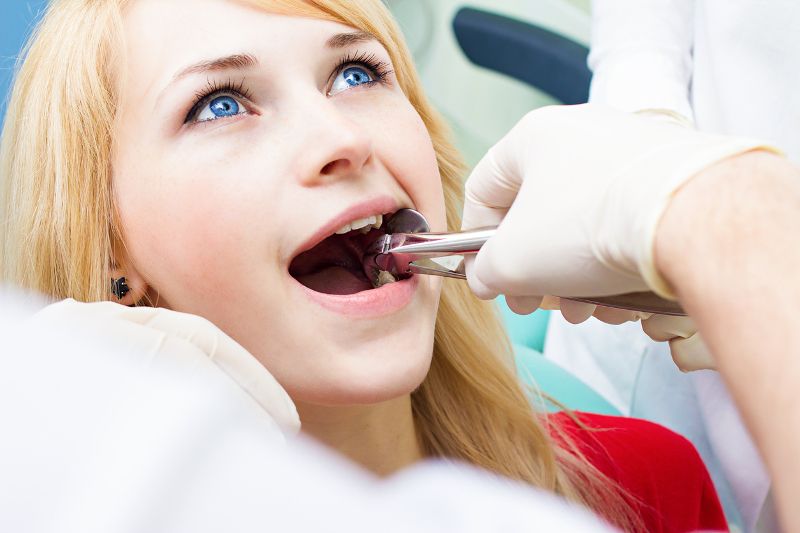Ekstrakcja zęba – wskazania, przeciwwskazania, przebieg zabiegu